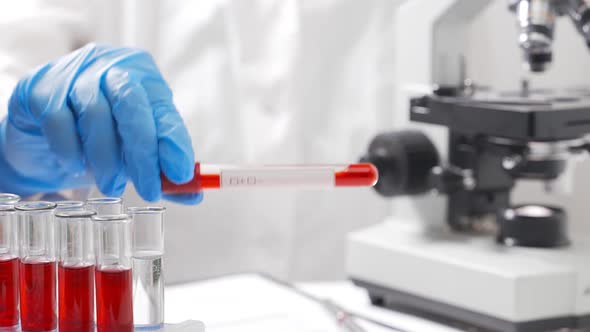 The Laboratory Assistant Performs a Microbiological Analysis of Blood Smears