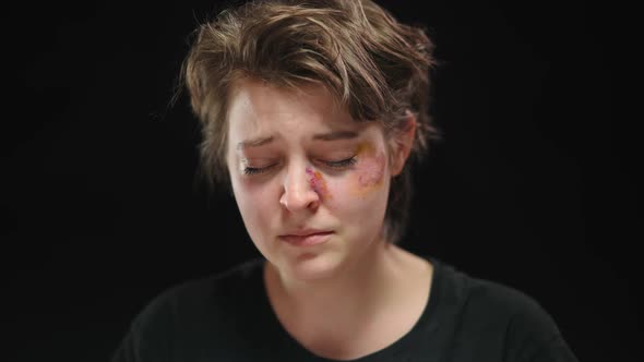 Closeup Beaten Face of Abused Crying Young Woman Looking at Camera