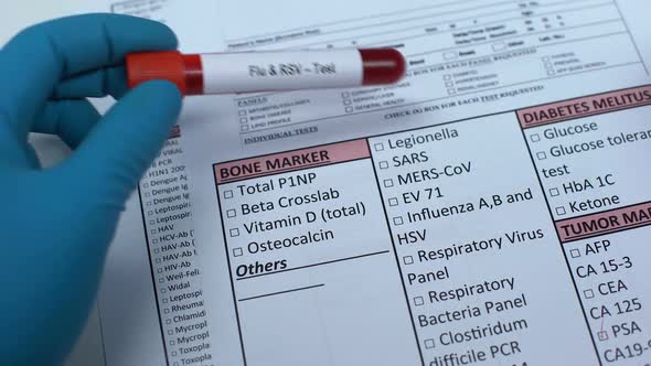 Flu and RSV, Doctor Checking Disease in Lab Blank, Showing Blood Sample in Tube