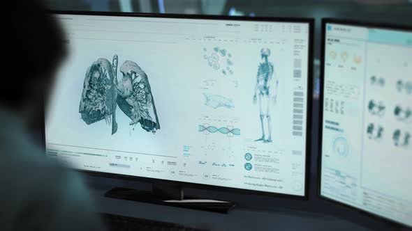 Ill Patient Health Analysis Observes Dangerous Lung Cancer Disease At A Lab alt