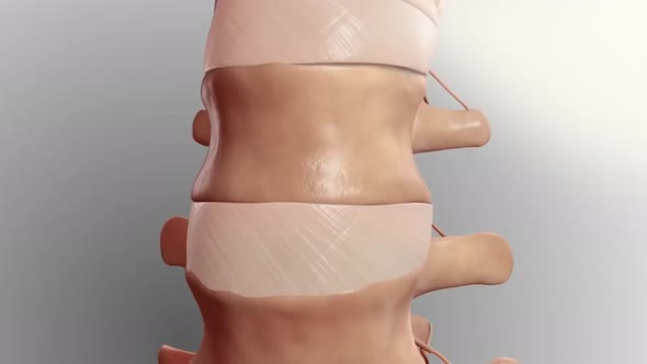 Cervical spine .Chronic Low Back Pain