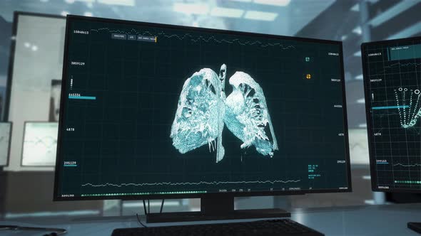Sorting through Covid-19 CT scans. 3D X-ray data analysis. Medical research. UI alt