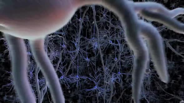 Neurons With Amyloid Plaques, Animation