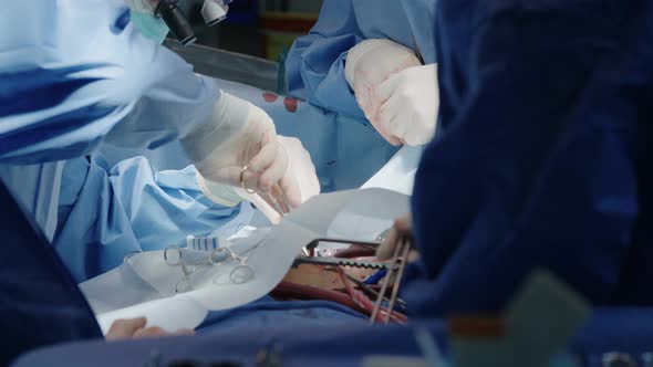 Surgeons working during open heart surgery, close up on hands and instruments.