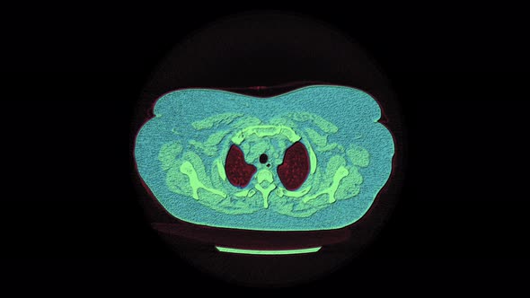 Color MRI Scan of the Lungs and Bronchi, Diagnosis of Respiratory Diseases