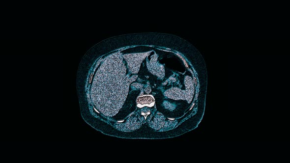 Bulk Multicolored MRI of the Abdominal Cavity, Gastrointestinal Tract, Bladder