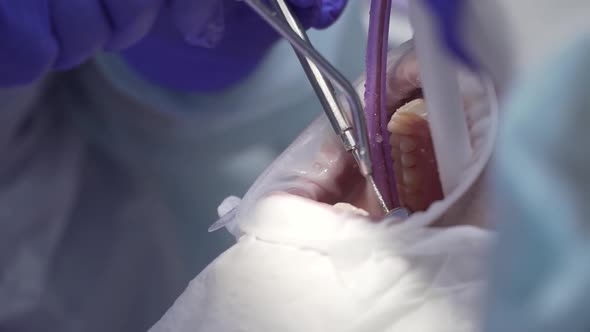 Dentist Conducts Dental Hygiene To the Patient