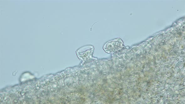 Parasitic ciliate of family Trichodinidae under a microscope, Order Mobilida