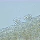 Parasitic ciliate of family Trichodinidae under a microscope, Order Mobilida - VideoHive Item for Sale