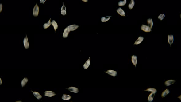 Rotifera Keratella Cochlearis Under the Microscope