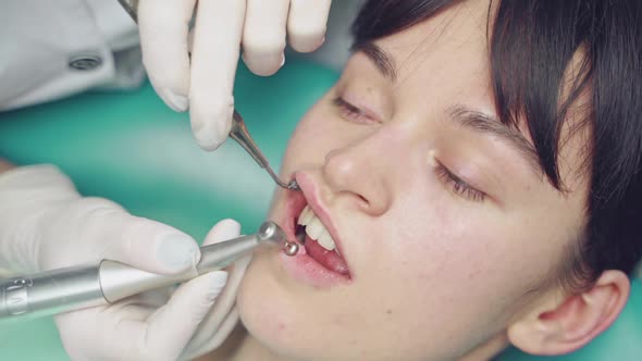 Stomatologist in white gloves cleaning the teeth of a woman in dental cabinet.