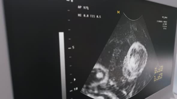 Prenatal diagnostic scanner is checking the baby carried by a pregnant female alt