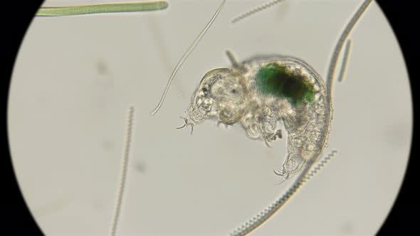  The Water Bear Tardigrada