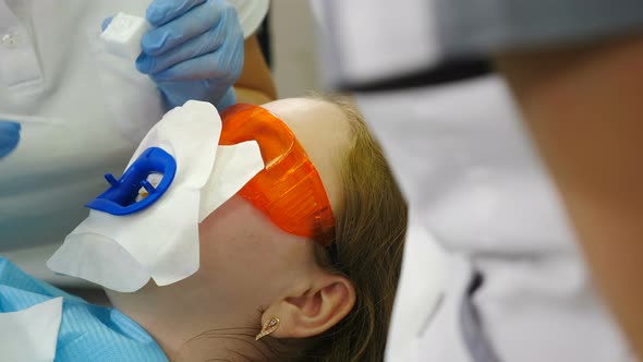 Preparation for Professional Teeth Whitening or Bleaching Procedure in Modern Dental Clinic