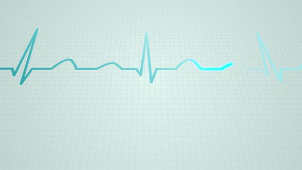 Animation of a schematic diagram of normal sinus rhythm for a human heart