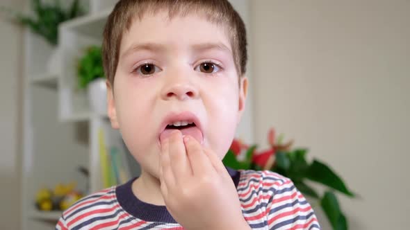 A 4Yearold Boy Puts a Large White Pill in His Mouth