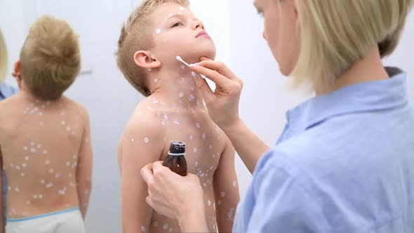 Mother Applying Antiseptic Cream Onto Son Skin