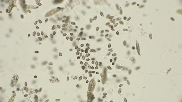 a Large Colony of Ciliates Coleps, Which Are Largely Located in Dirty Water Under a Microscope