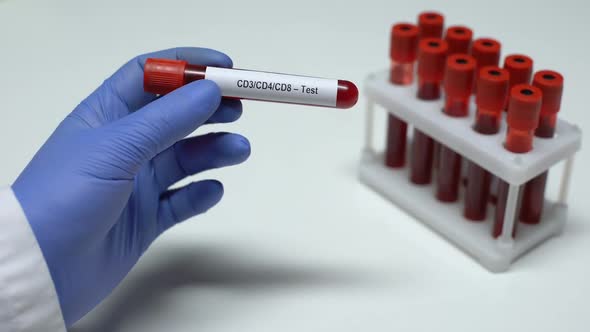 CD3 CD4 CD8, Doctor Showing Blood Sample in Tube, Lab Research, Health Checkup