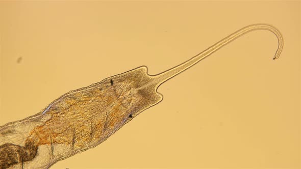 Worm of the Family Naididae Under a Microscope