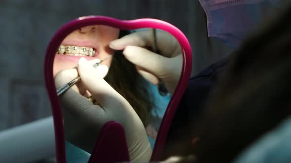 Visit and Consultation of the Dentist, Installation of Braces