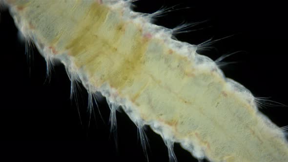 Worm Polychaeta Family Amphinomidae Under a Microscope