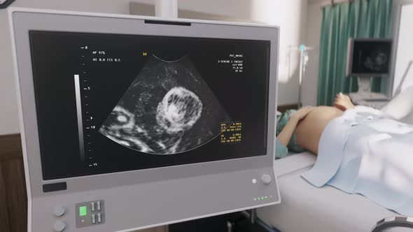 A specialist is performing a screening test to analyze the health of the baby alt