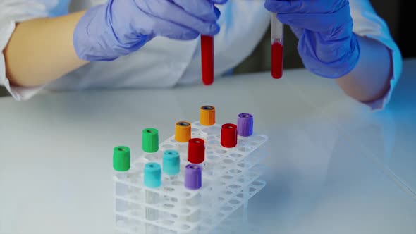 Medical equipment for blood test. Hands of doctor holding bottles of blood