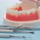 plastic model of the jaw with white teeth and various dental instruments - VideoHive Item for Sale