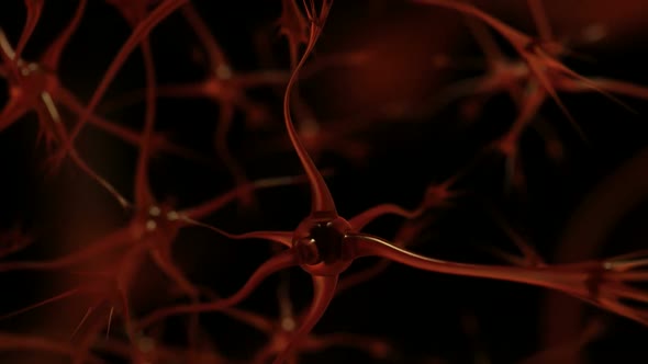 Neurons With Amyloid Plaques, Animation