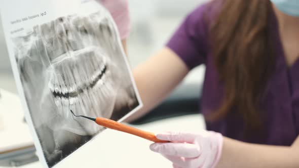 Dentist showing a panoramic dental x-ray to a patient, smile and teeth radiology x ray concept