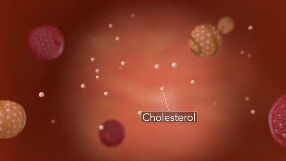 Atherosclerosis, Cholesterol And Other Substances In And On The Artery Walls.