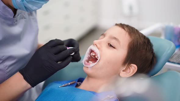 Woman Doctor in Dental Clinic Serve Patient Little Boy with Damaged Baby Teeth