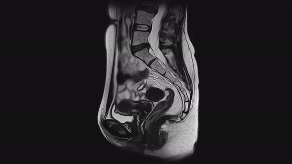 MRI of the Female Pelvic Organs, Abdominal Cavity, Gastrointestinal Tract and Bladder