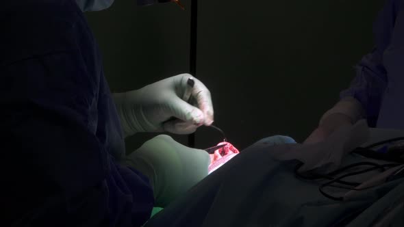 Crop doctor suturing wound after rhinoplasty operation