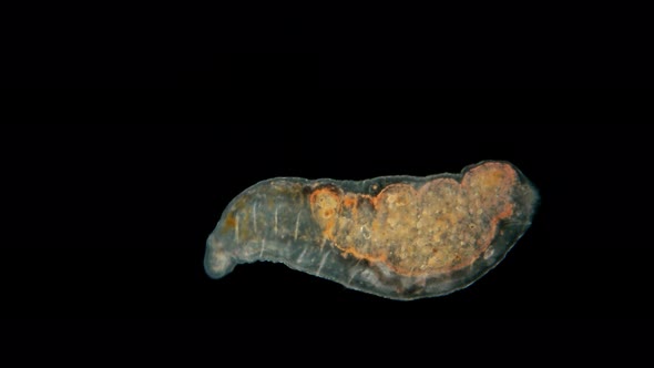 Aeolosoma Worm Under a Microscope