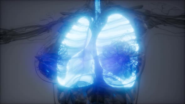 Human Lungs Radiology Exam