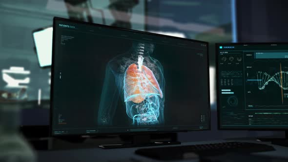 A Tomography Analysis is Used to Scan Thorugh the Body to Find the Deadly Virus alt