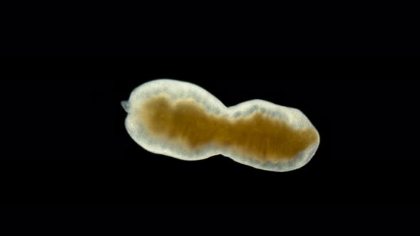 Microturbellaria Worm Under the Microscope, Phylum Platyhelminthes