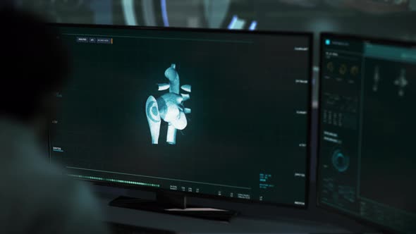 Futuristic Scanner diagnosing the patient with a deadly Cardiac Ischemia Disease alt