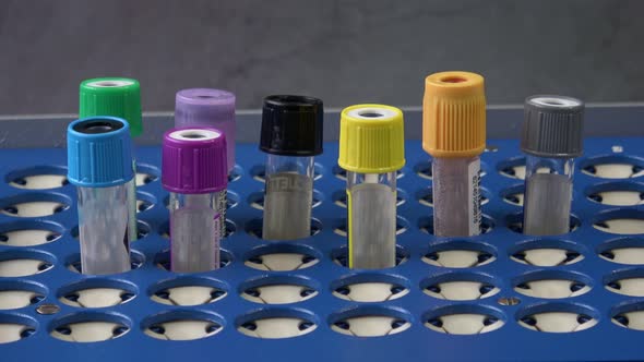 Plastic test tubes with caps for the collection of samples. Medical modern medicine