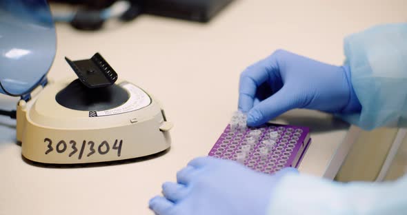 Scientist Putting Test Tubes with Bacteria in Shaker at Laboratory