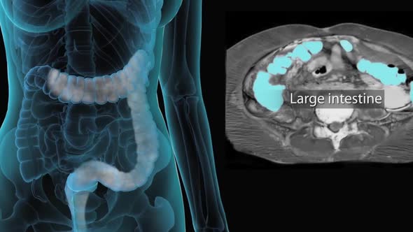 The large intestine includes the colon, rectum and anus.