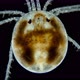 Water mite Hydrachnidia under a microscope, order Trombidiformes - VideoHive Item for Sale