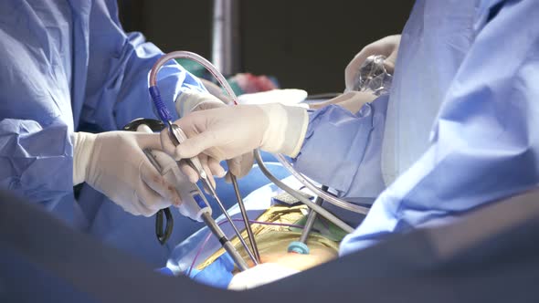 Surgeons working during surgery, close up on hands and instruments.