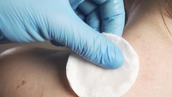 Greasing Ointment on Person Surgical Wound