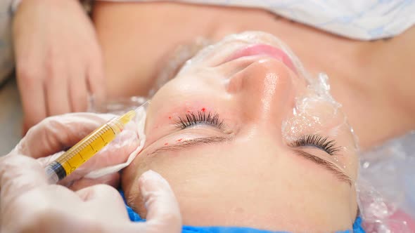 Cosmetologist Making Plasma Injections to Female Face