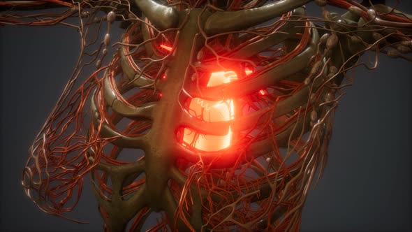 CG Animation Of A Sick Human Heart alt