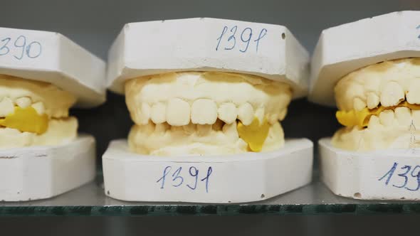 Dental Gypsum Models Cast of a Human Dental Jaw