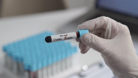 Close Up of Medical Hand in Glove with Blood Test Tube. Covid-19 Negative